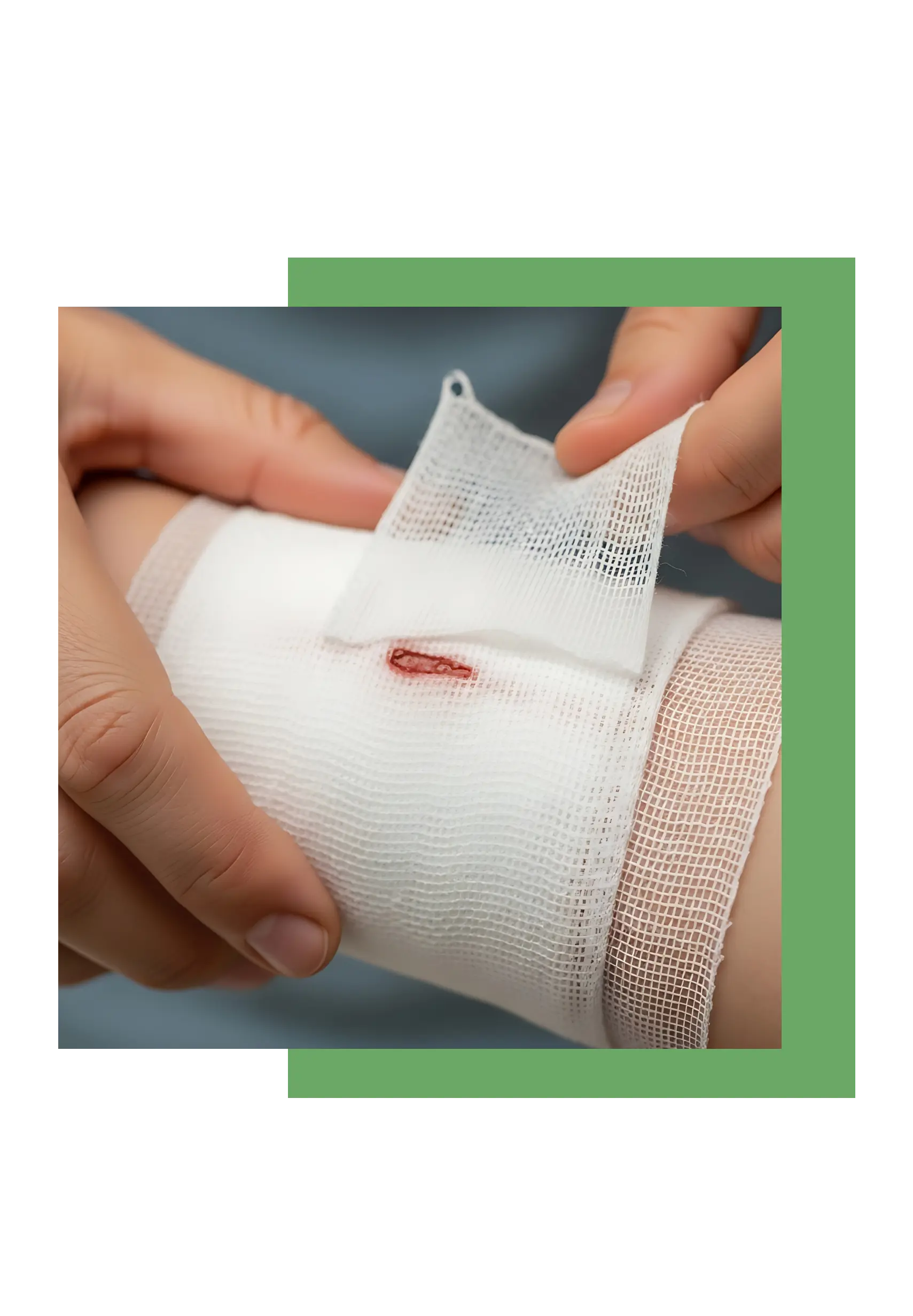 schnittwunde-behandeln